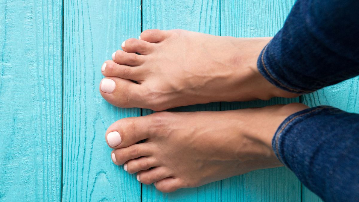 Fact-check: Does having flat feet bring health problems? | The Print